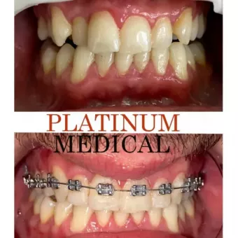 Platinum Medical клініка ортодонтії та стоматології