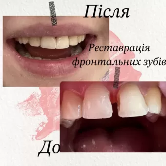 Стоматолог Помпій Еліна Сергіївна вул.Грушевського, 42 фото 5