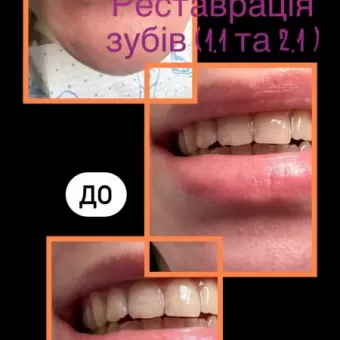Стоматолог Помпій Еліна Сергіївна вул.Грушевського, 42 фото 4