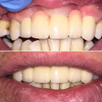 MIRA Dental (МІРА Дентал Стоматологія)
