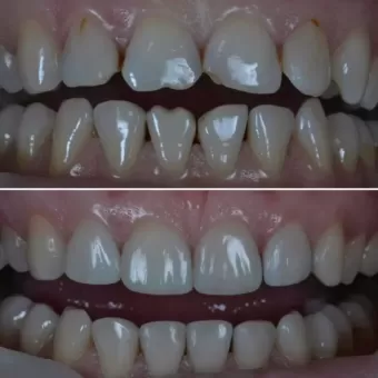 Cтоматологія Diamond Dental Clinic вулиця Соборна, 68 Бос фото 8