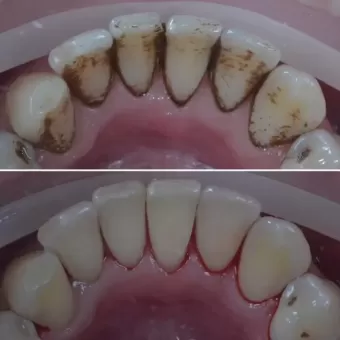 Cтоматологія Diamond Dental Clinic вулиця Соборна, 68 Бос фото 9