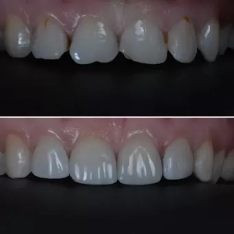 Cтоматологія Diamond Dental Clinic вулиця Соборна, 68 Бос фото 6