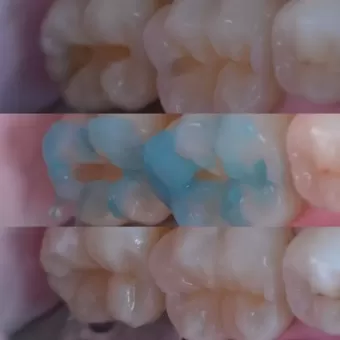Cтоматологія Diamond Dental Clinic вулиця Соборна, 68 Бос фото 5